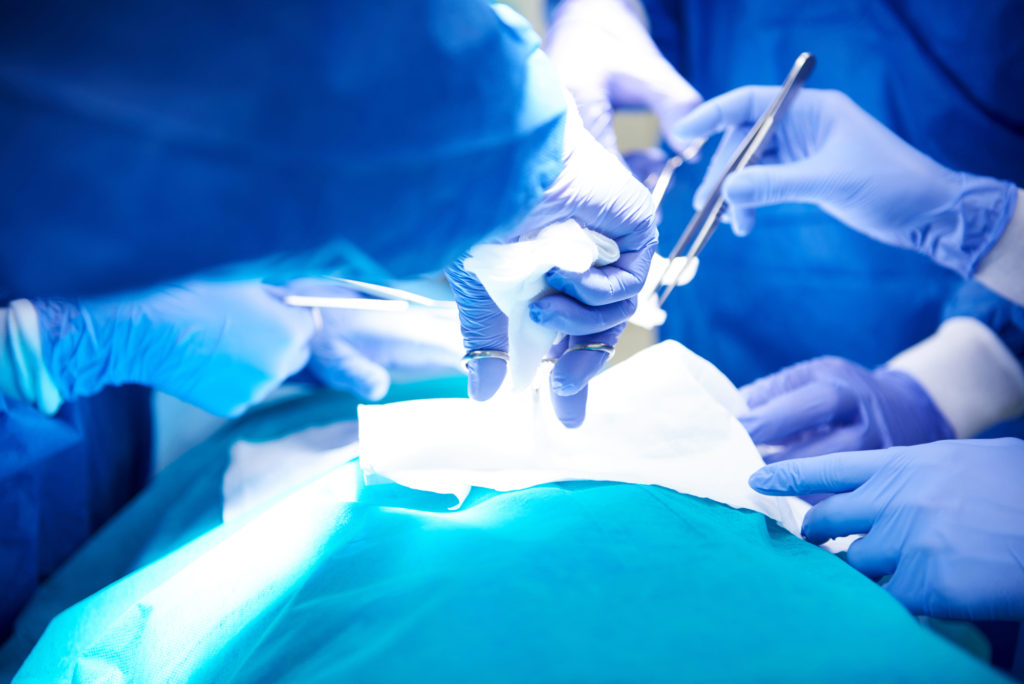 ניתוח בקע טבורי - כירורג מומחה פרטי דר סלבה ברד